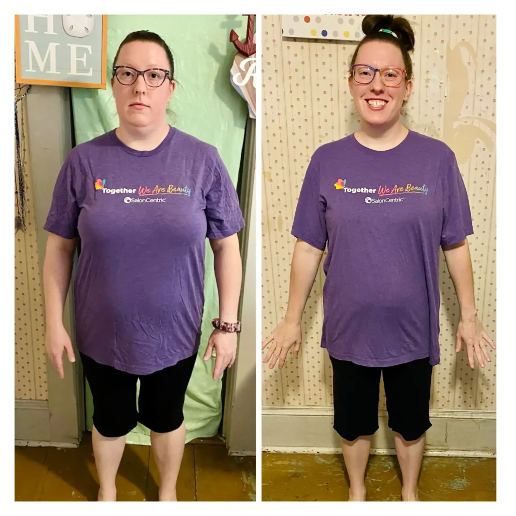 Nicole before and after weight loss front view