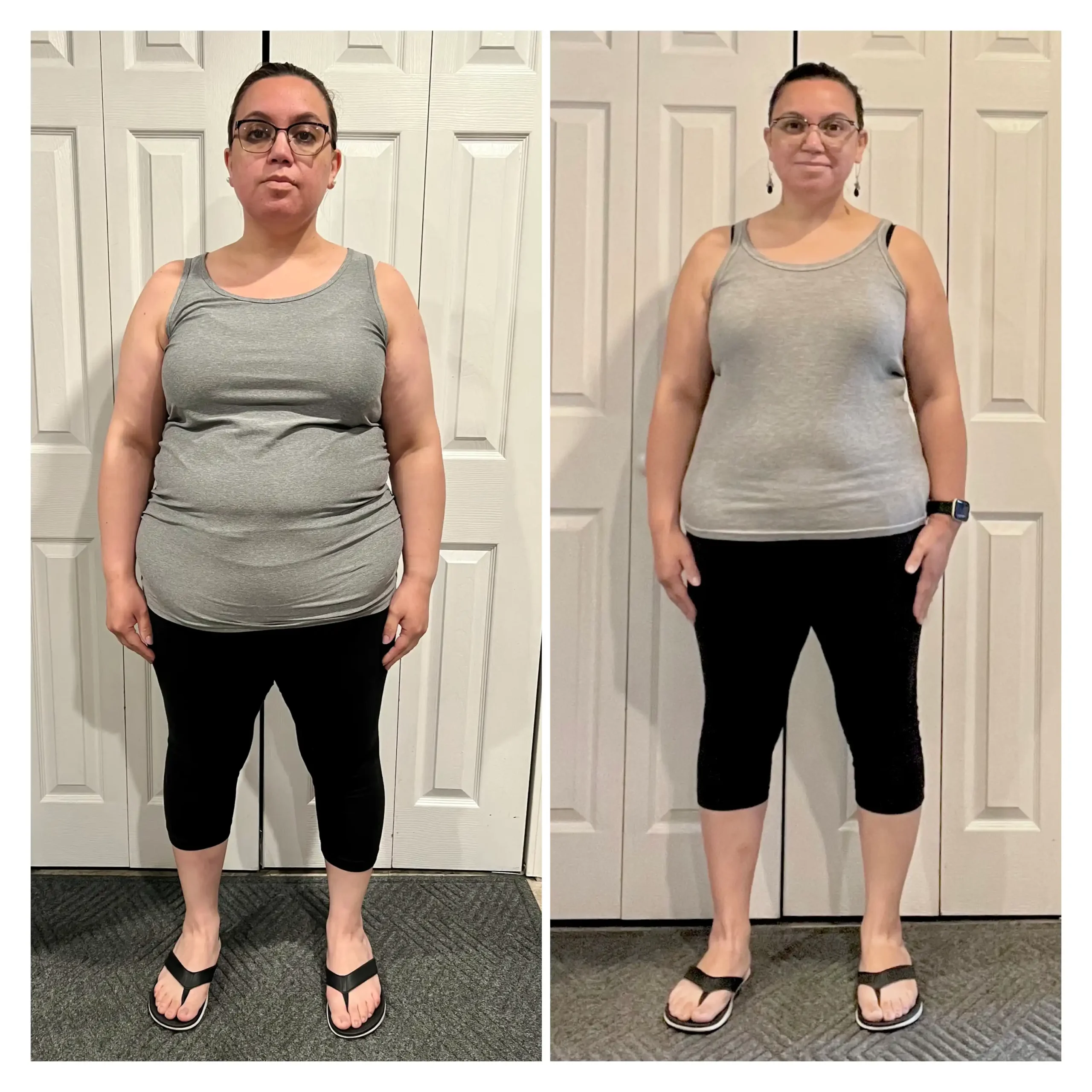 Tamara before and after weight loss front view