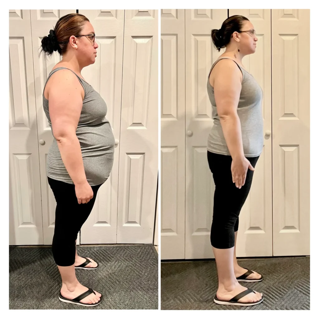 Tamara before and after weight loss side view