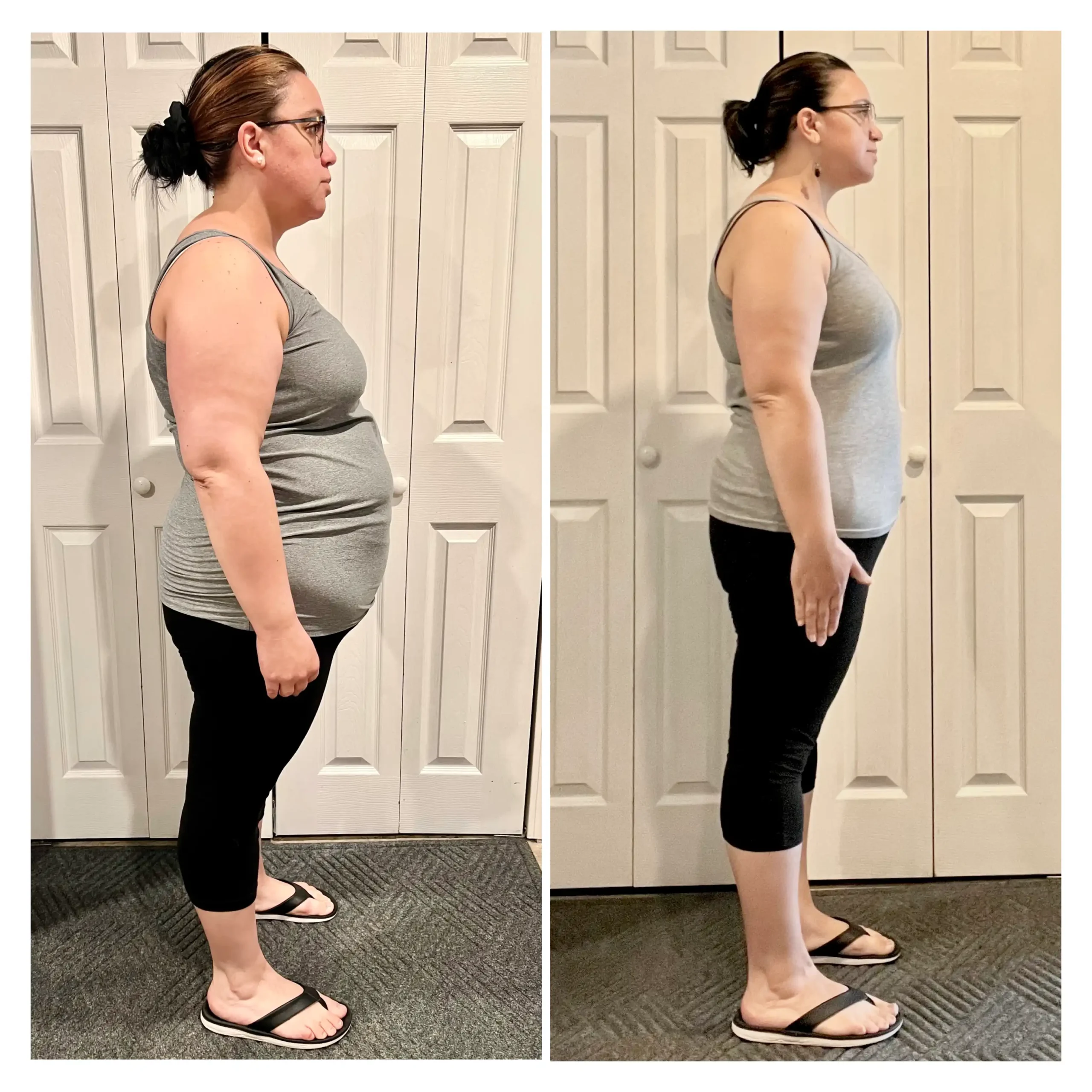 Tamara before and after weight loss side view