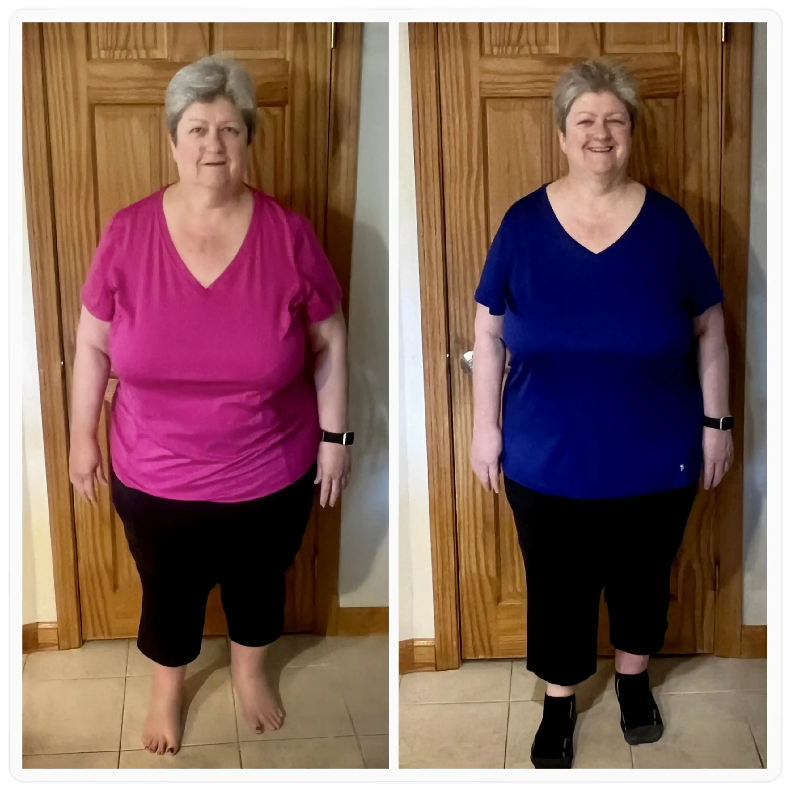 Linda before and after weight loss front view