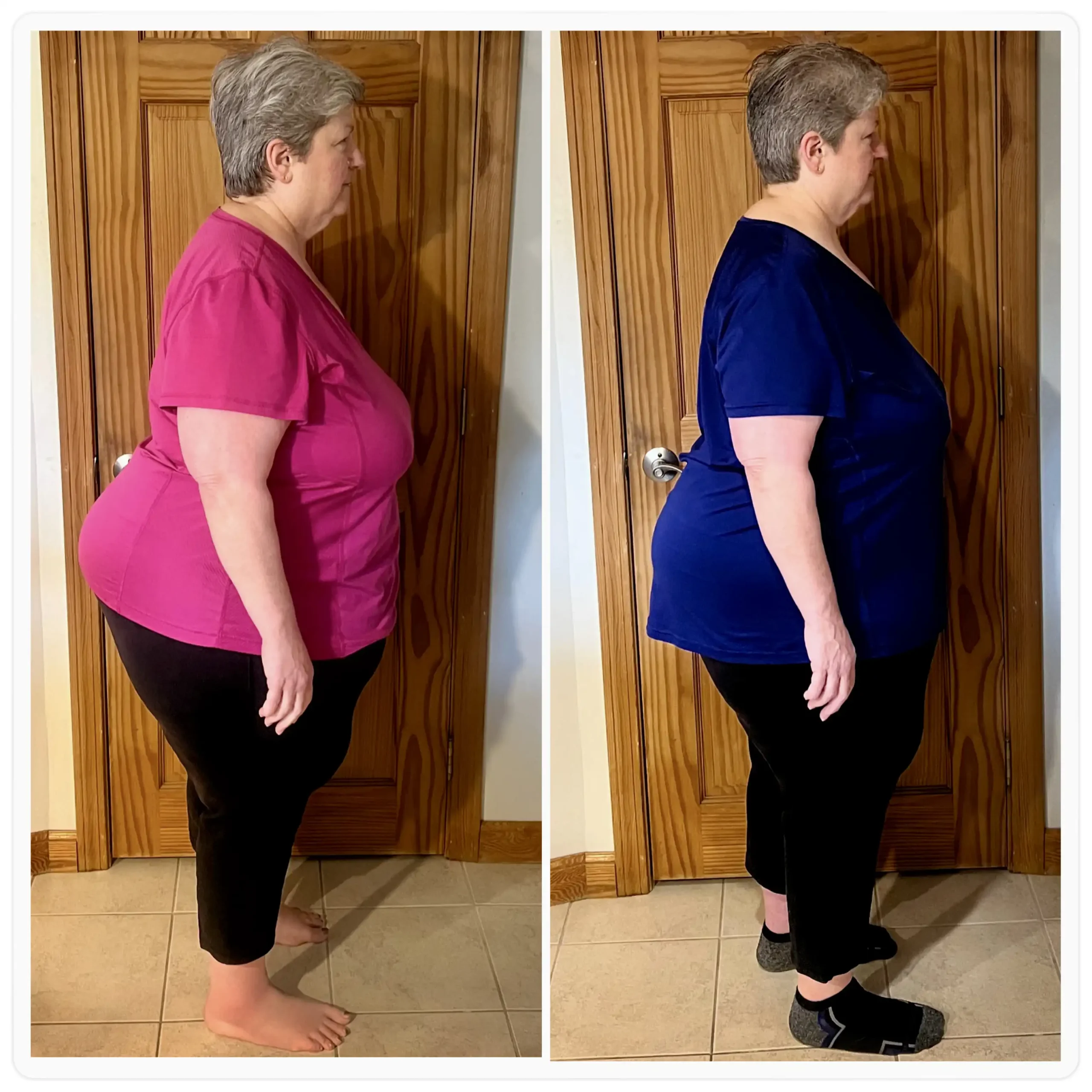 Linda before and after weight loss side view