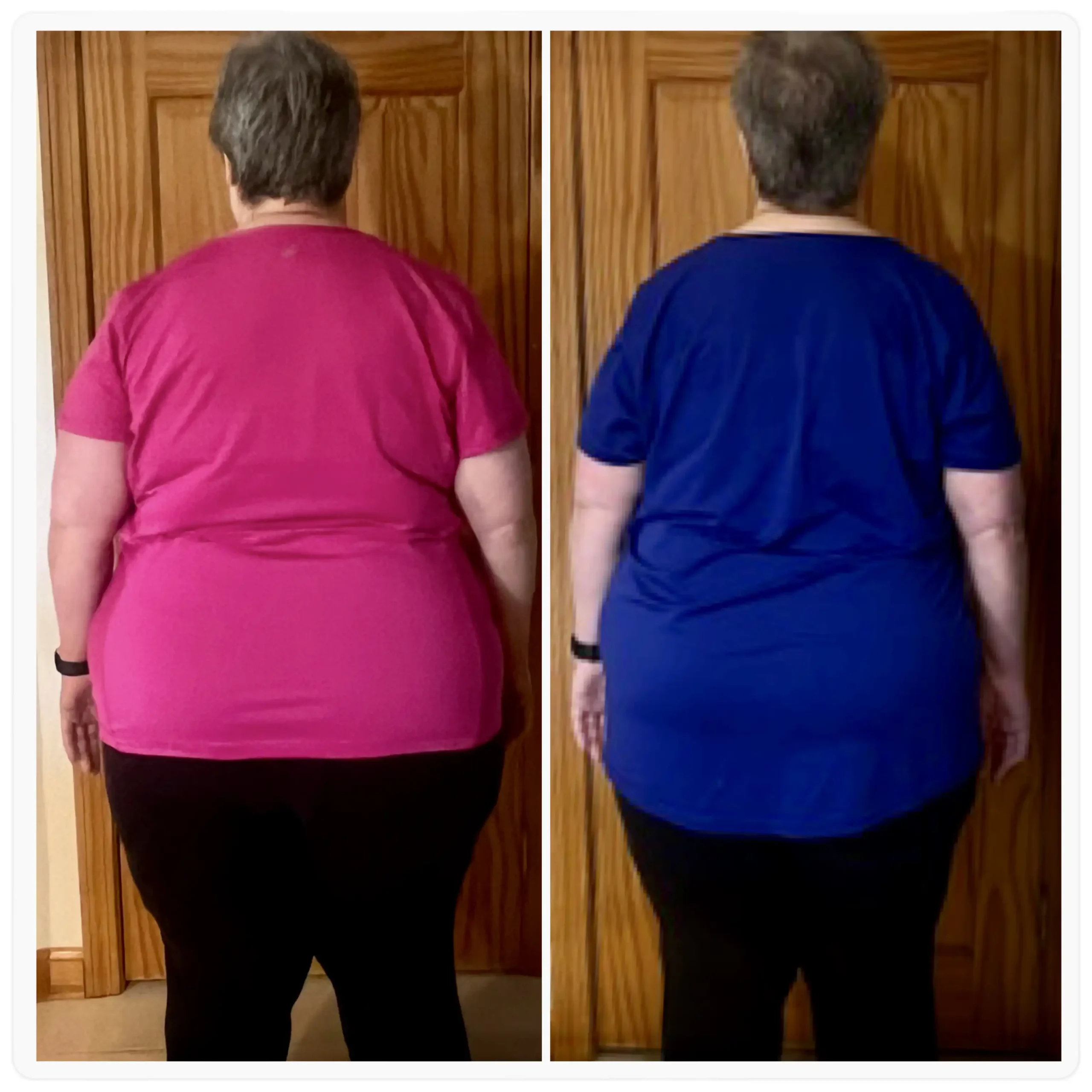 Linda before and after weight loss back view