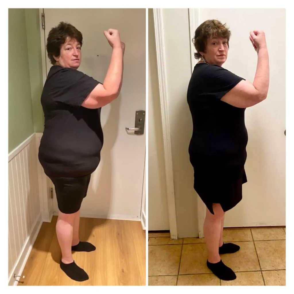 Debra before and after weight loss side view