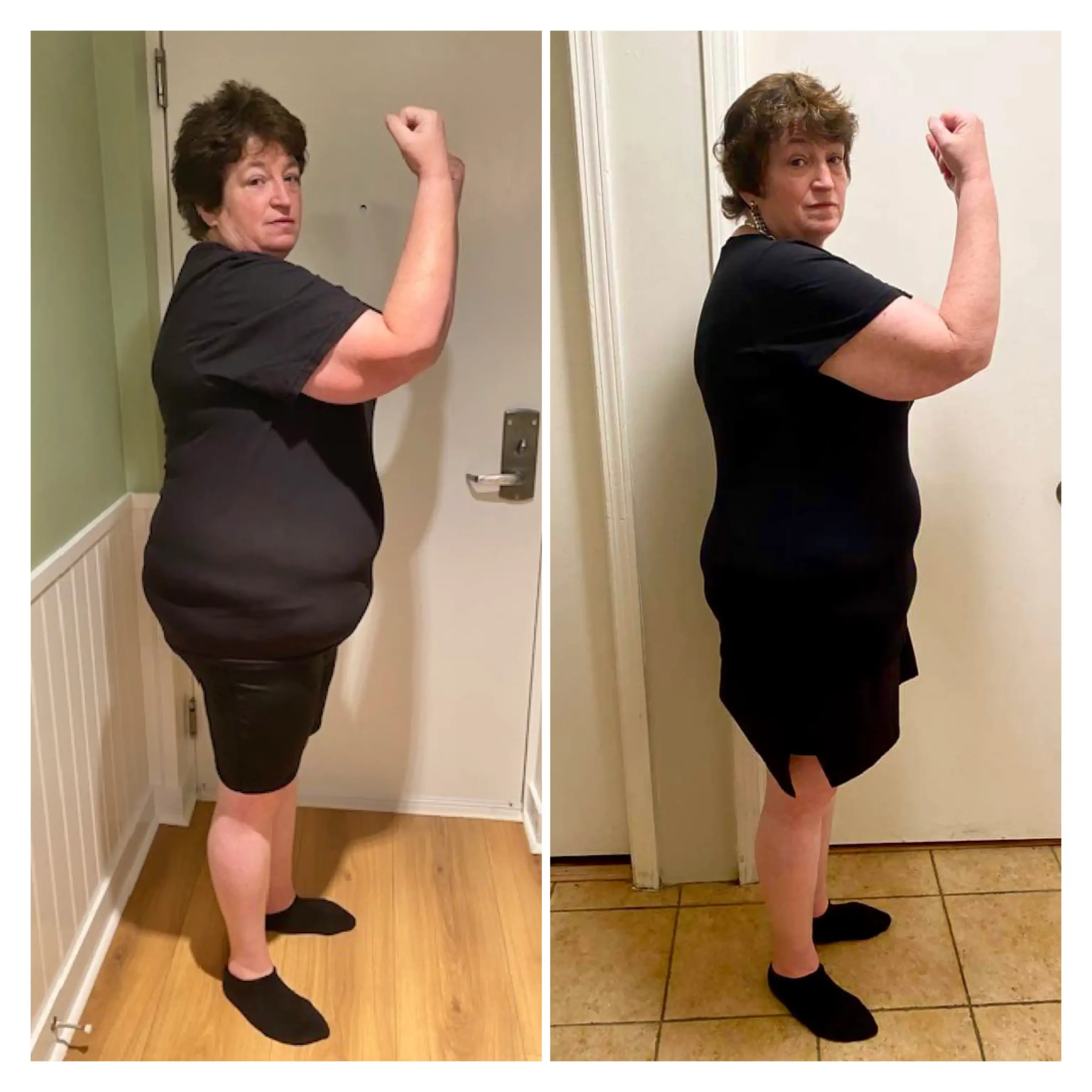Debra before and after weight loss side view