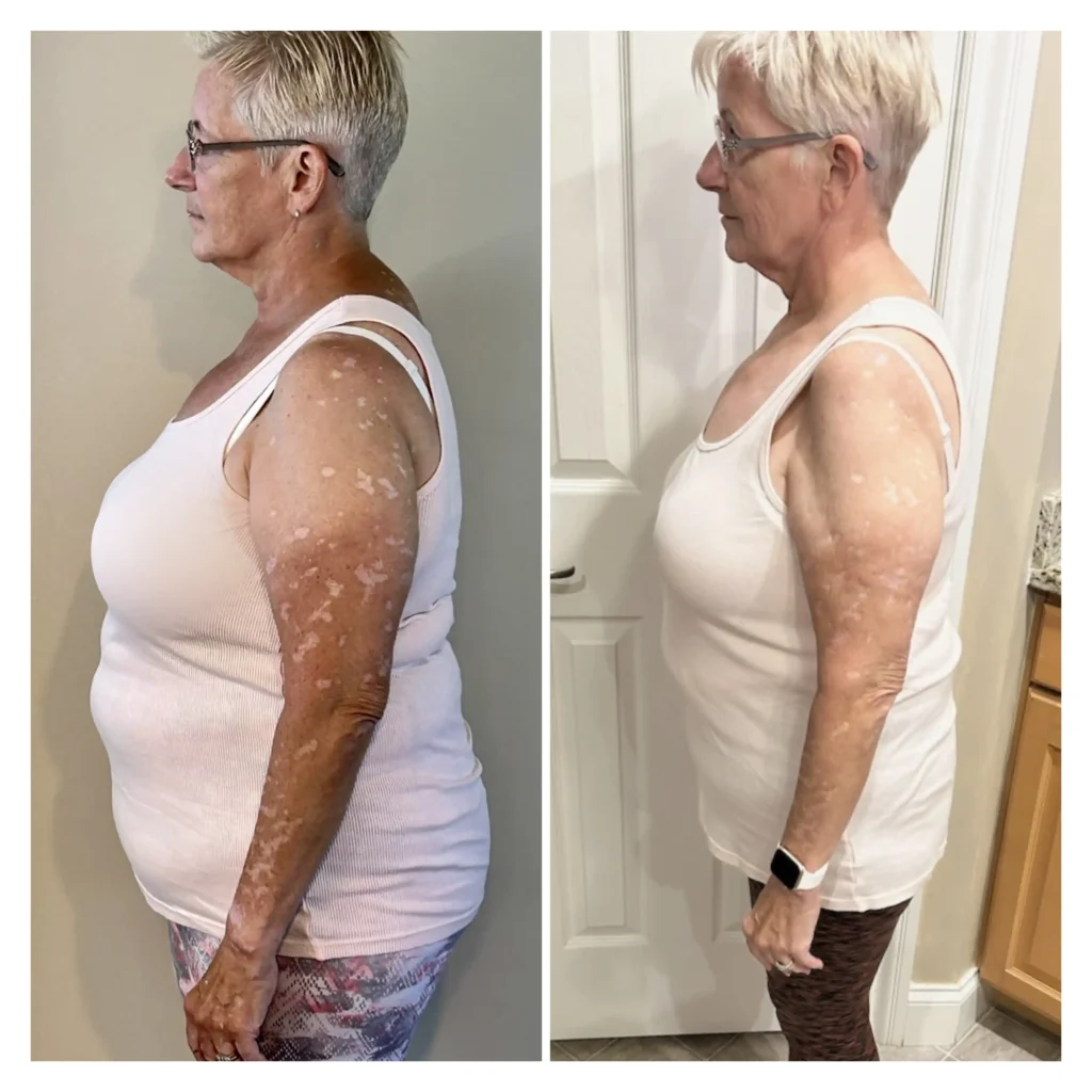 Lori before and after weight loss side view
