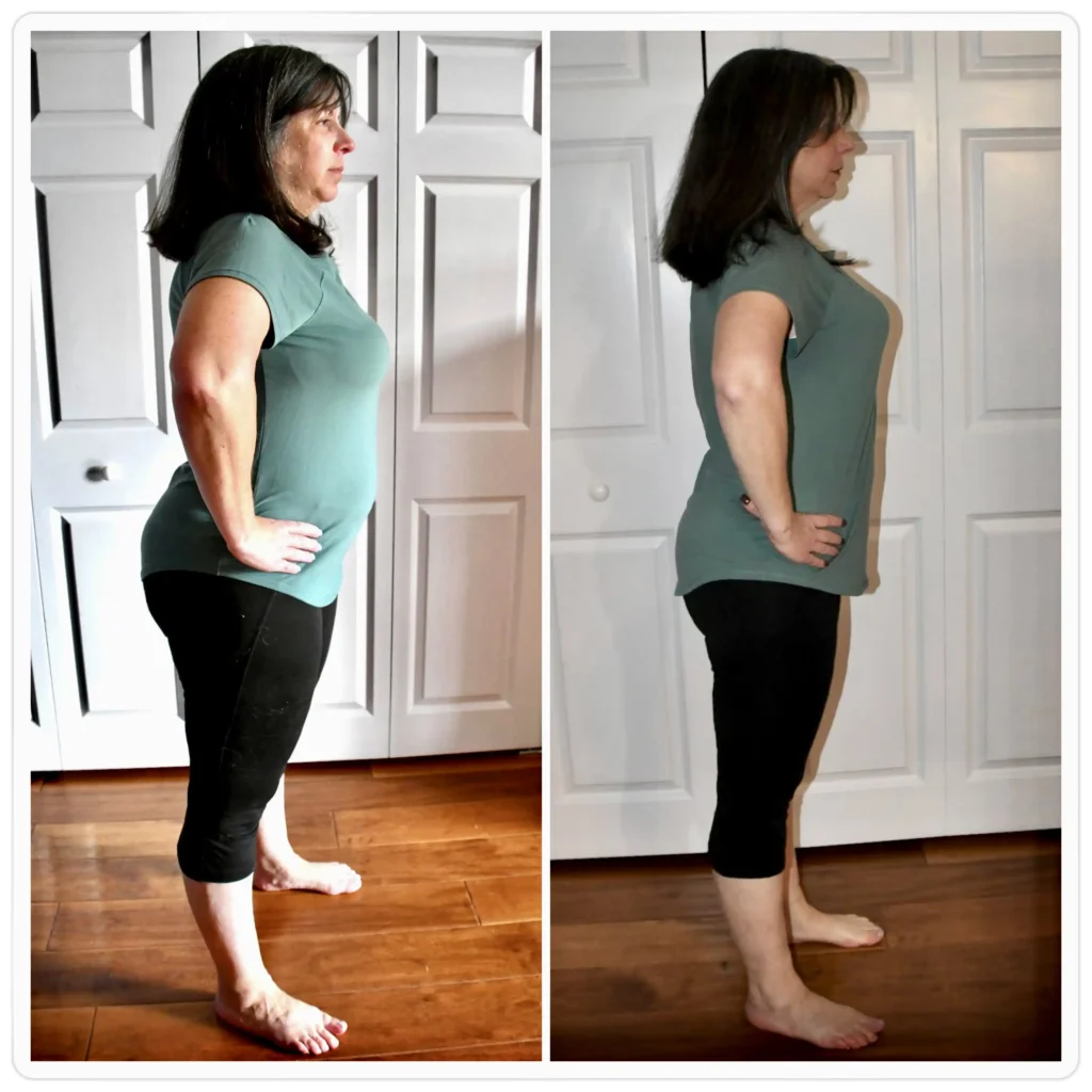 Barbara J before and after weight loss side view