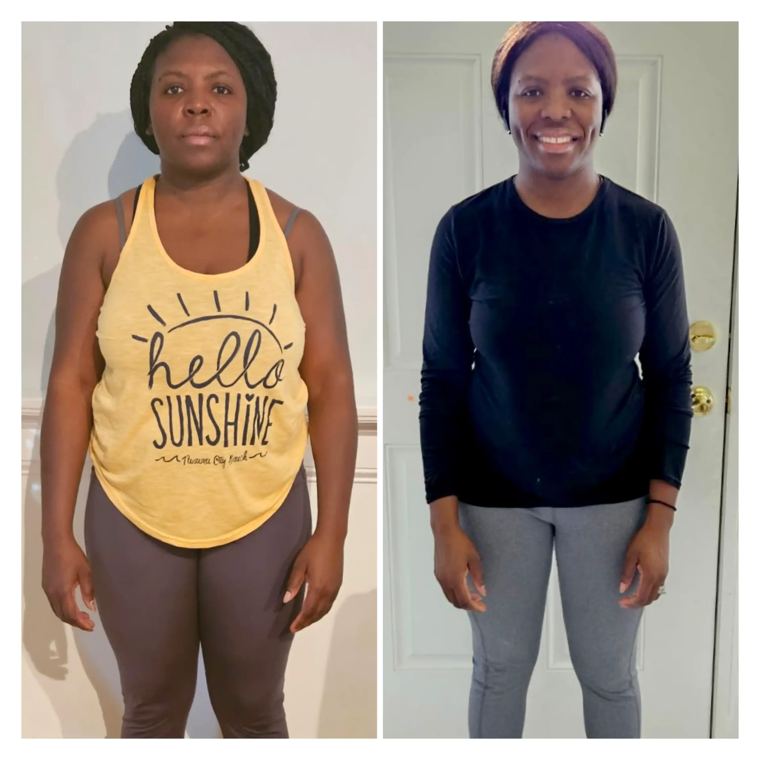 Tamara before and after weight loss front view