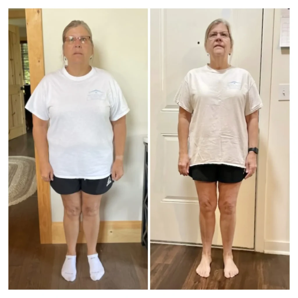 Joanne before and after weight loss front view