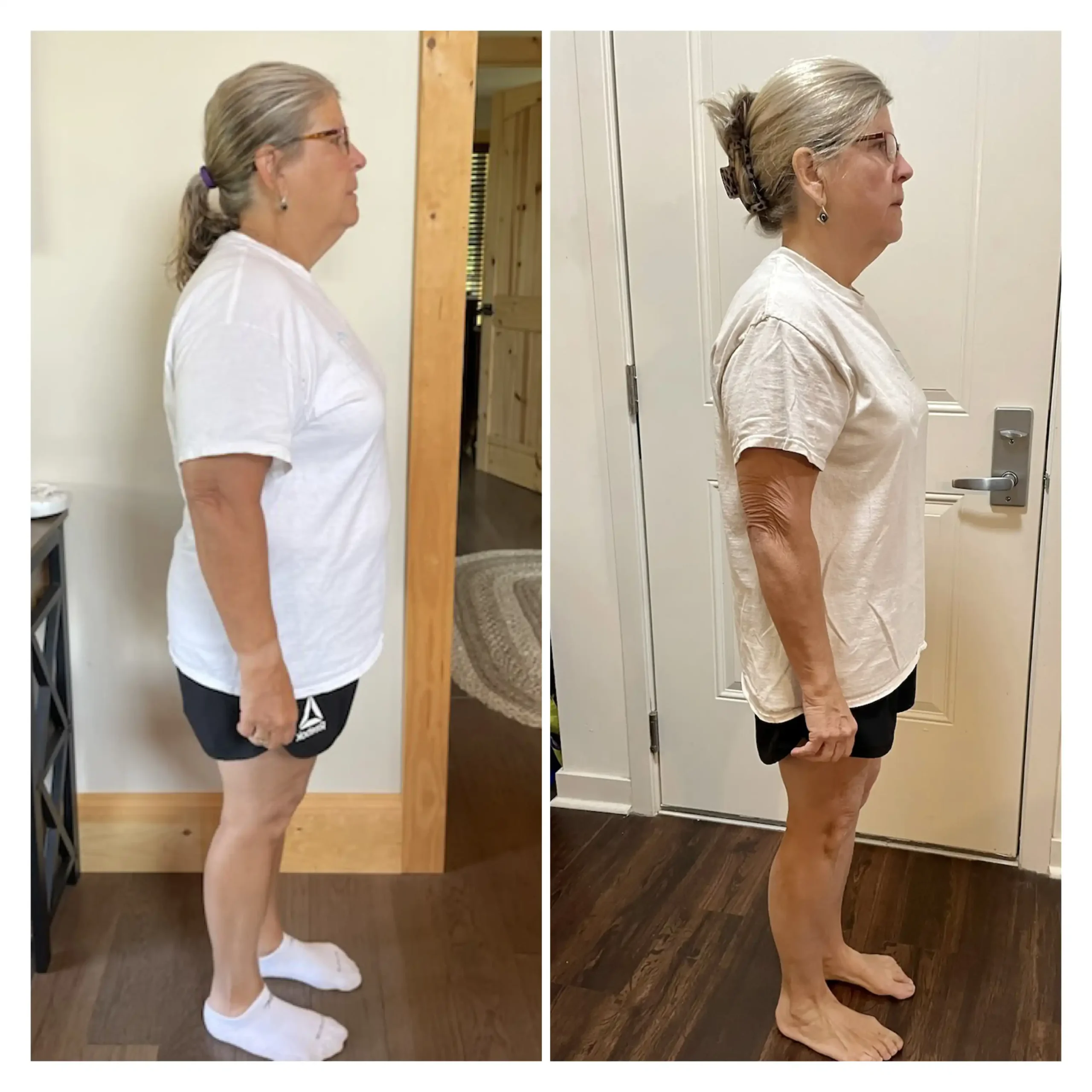 Joanne before and after weight loss side view