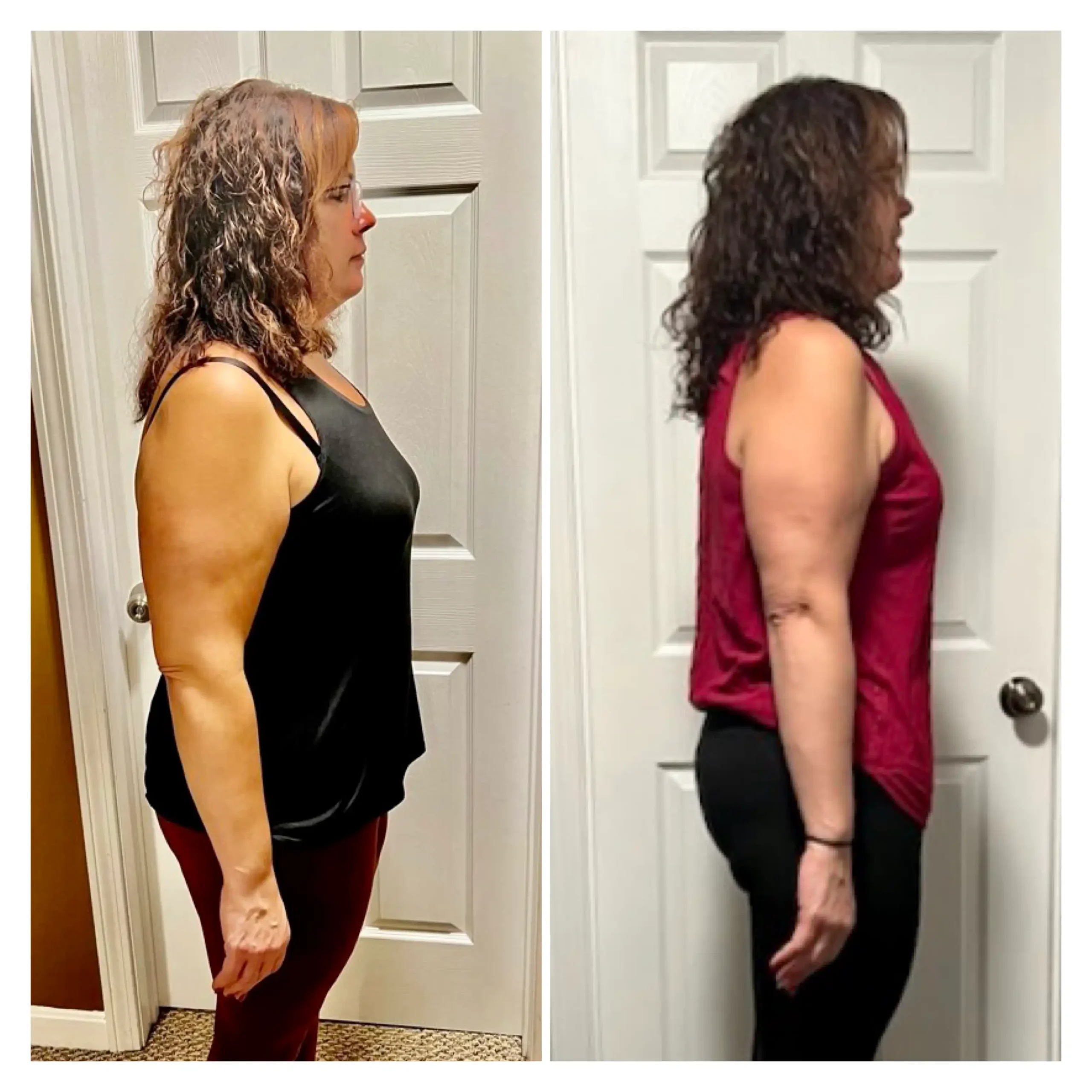 Angie before and after weight loss side view