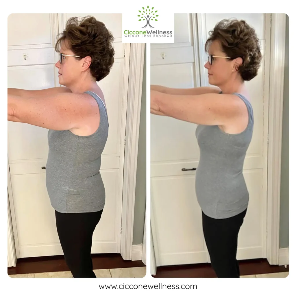Diana before after weight loss side view