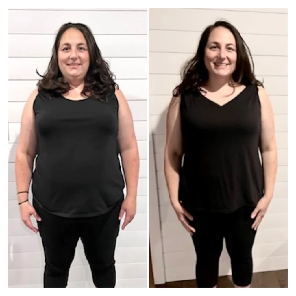 Keri before after weight loss front view