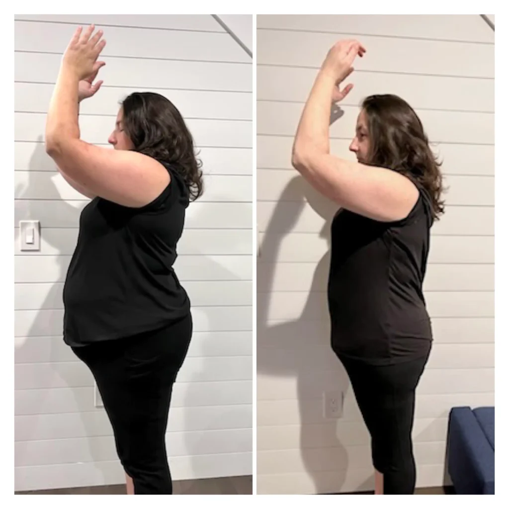 Keri before after weight loss side view
