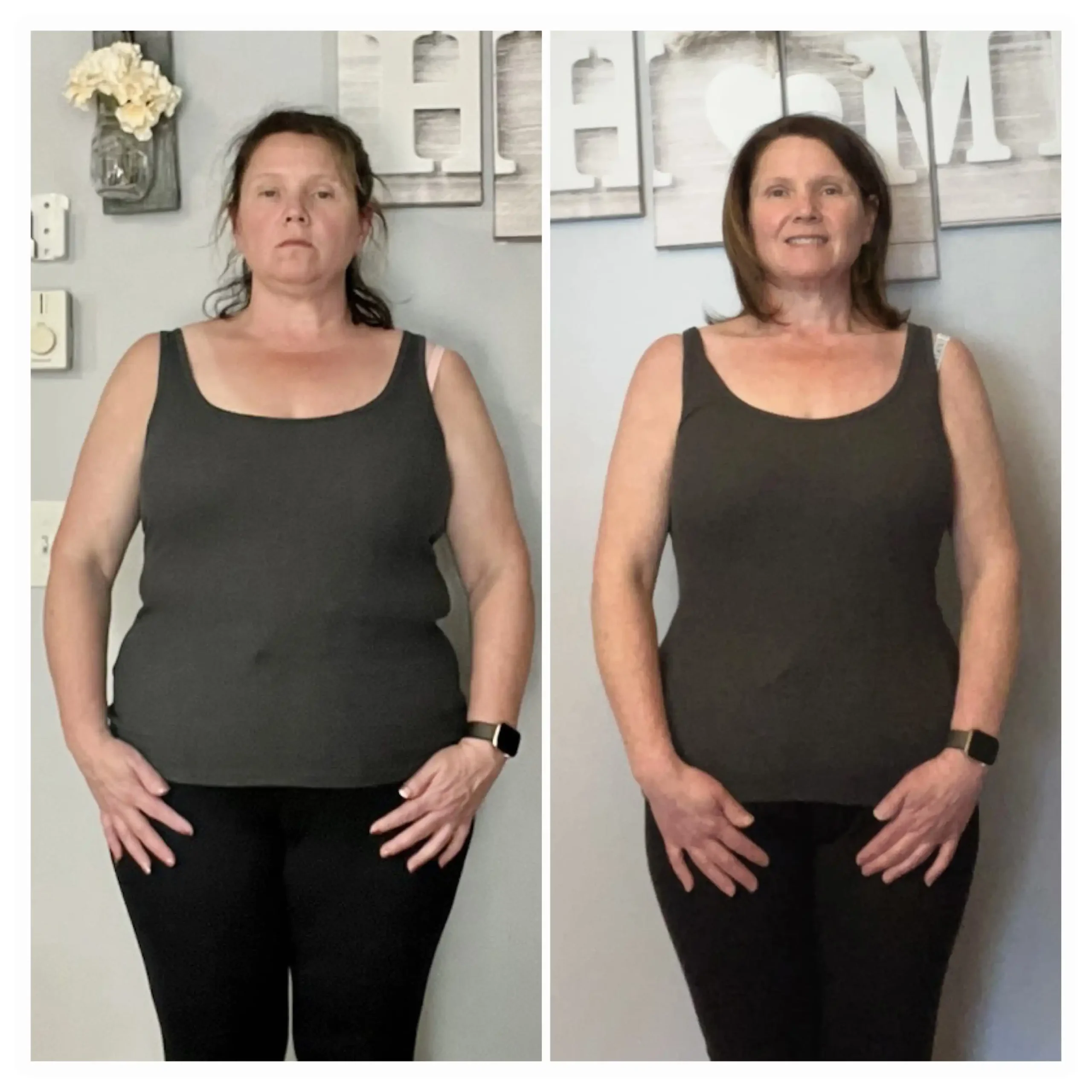 Lisa before and after weight loss front view