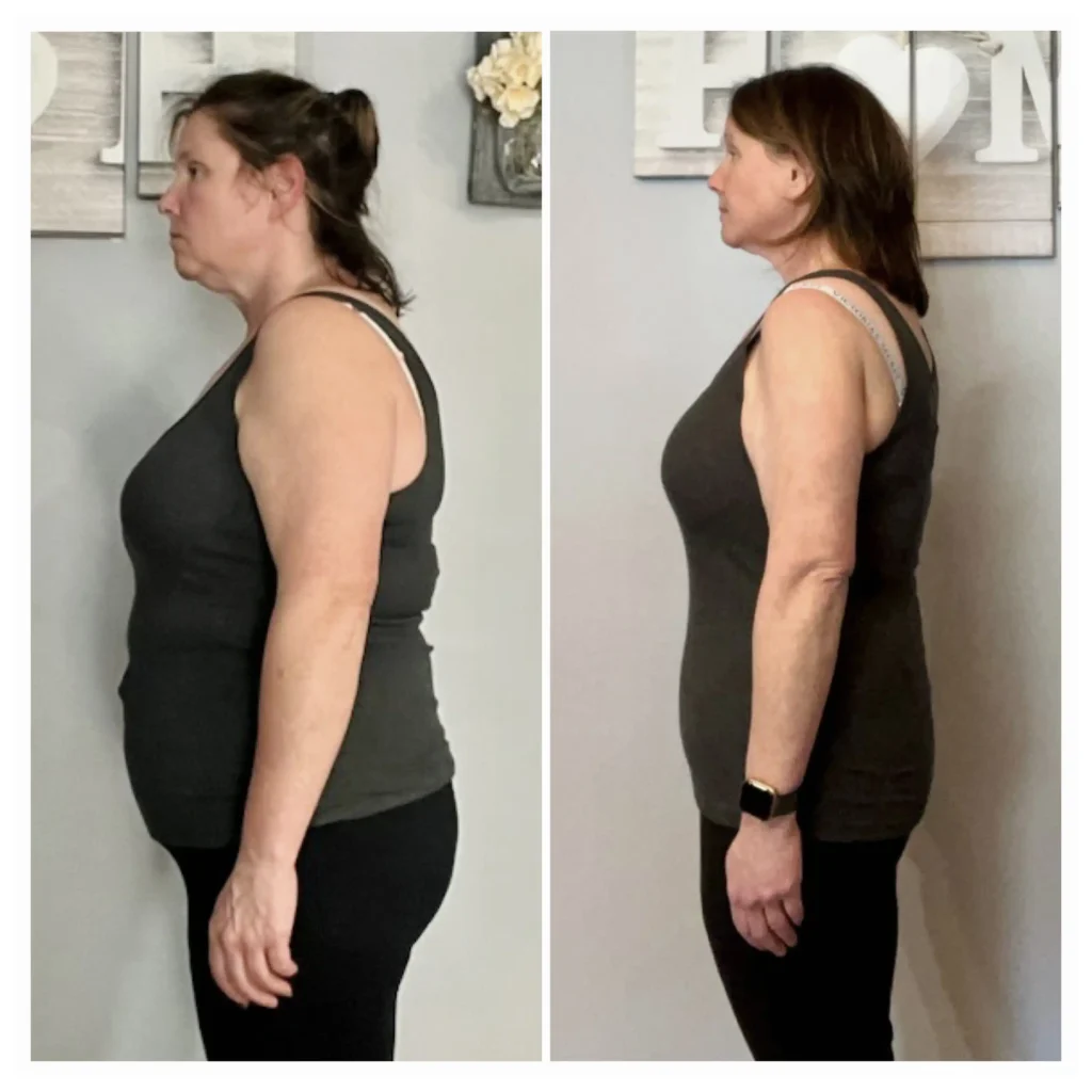 Lisa before and after weight loss side view