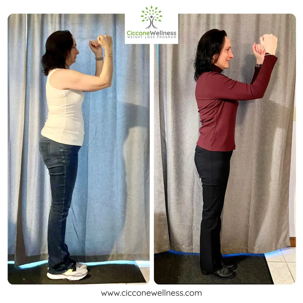 Renee before after weight loss side view