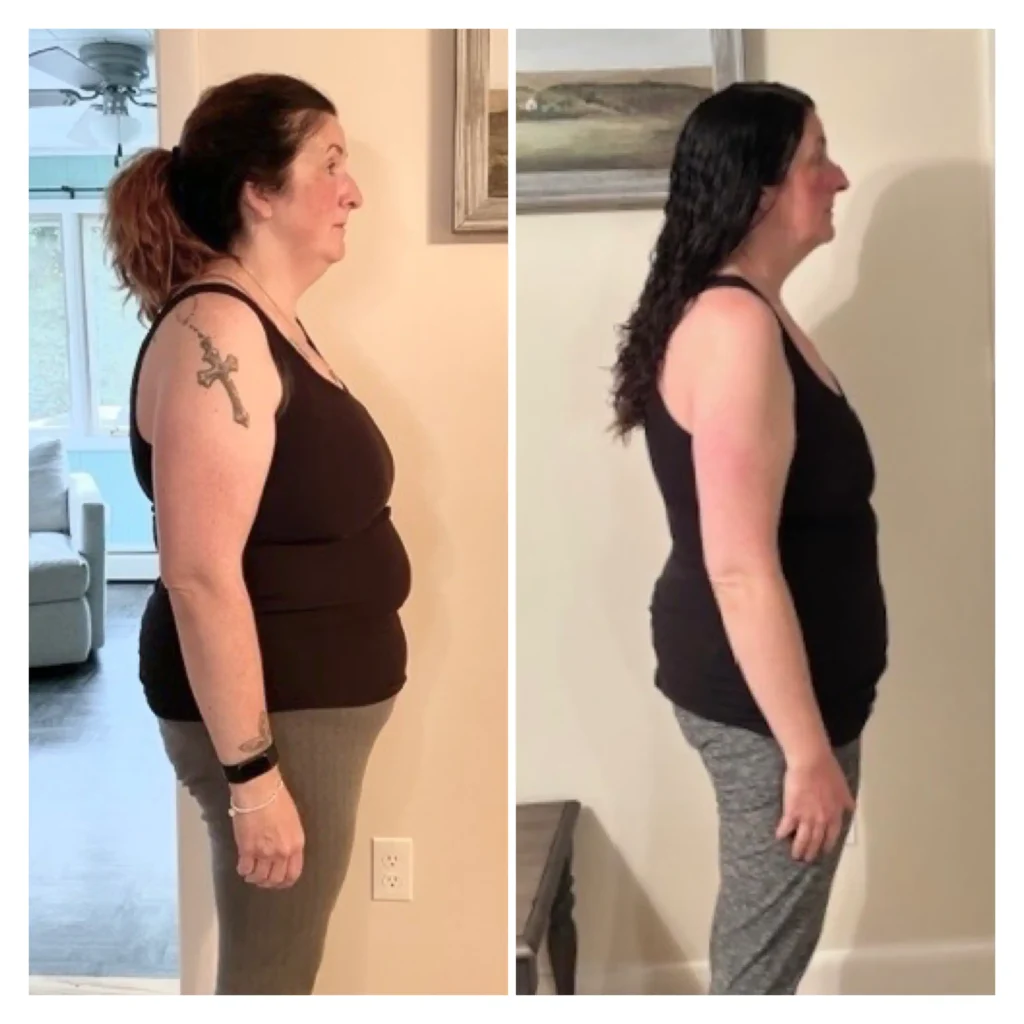 Trish before after weight loss side view