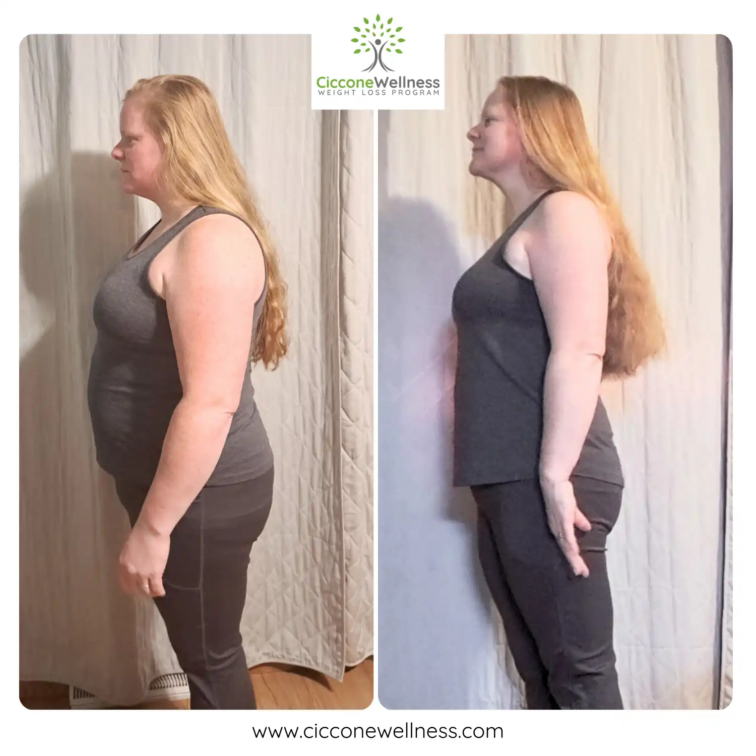 Amanda before and after weight loss side view