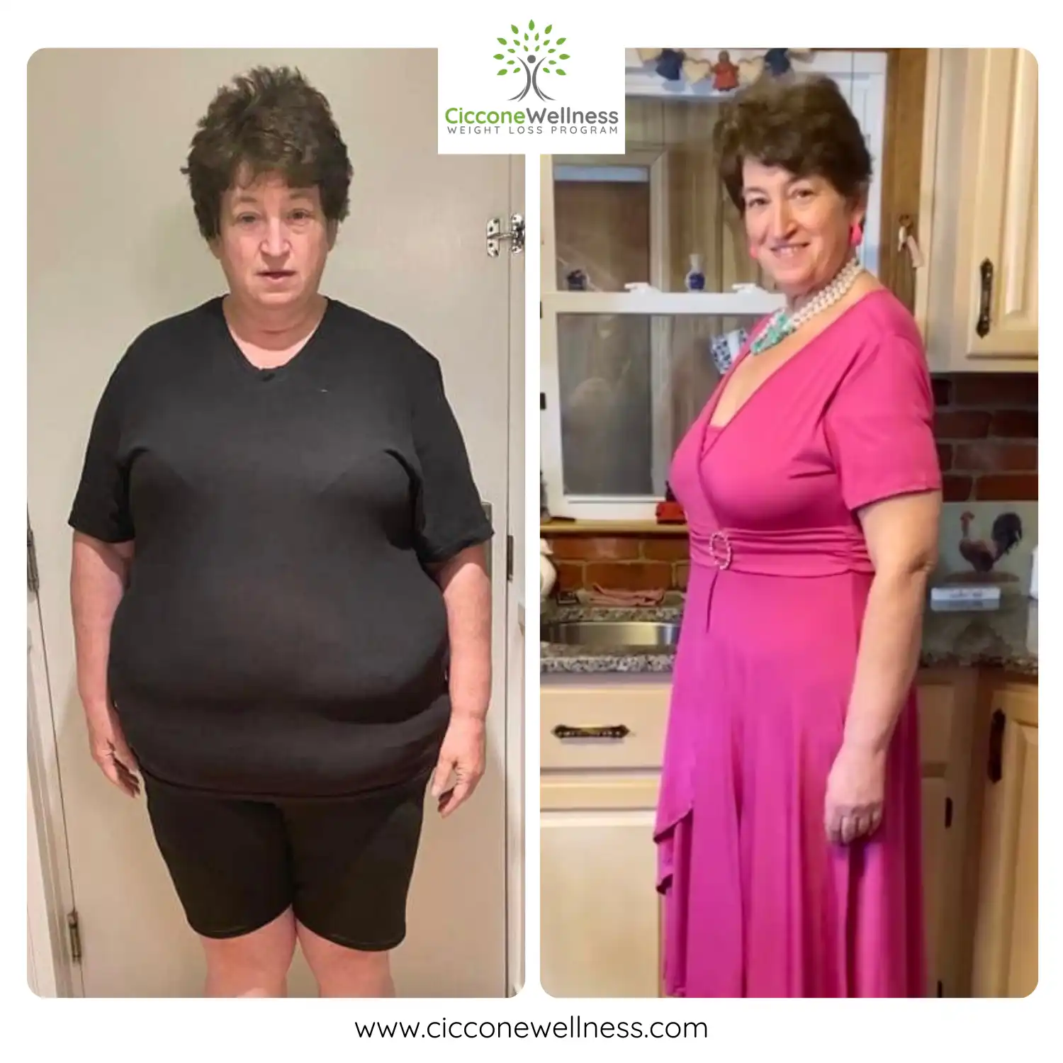 Debbie before and after weight loss