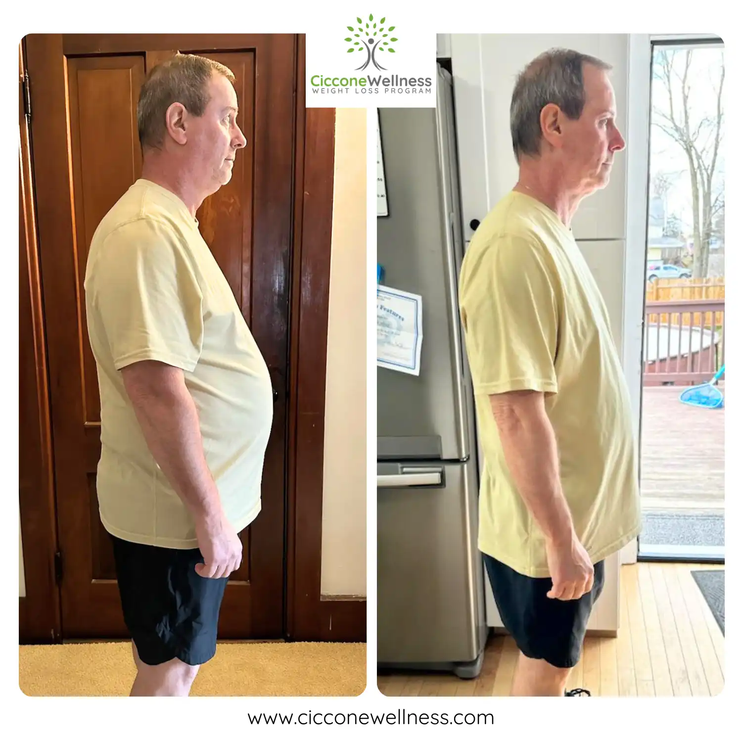 Ron before and after weight loss side view