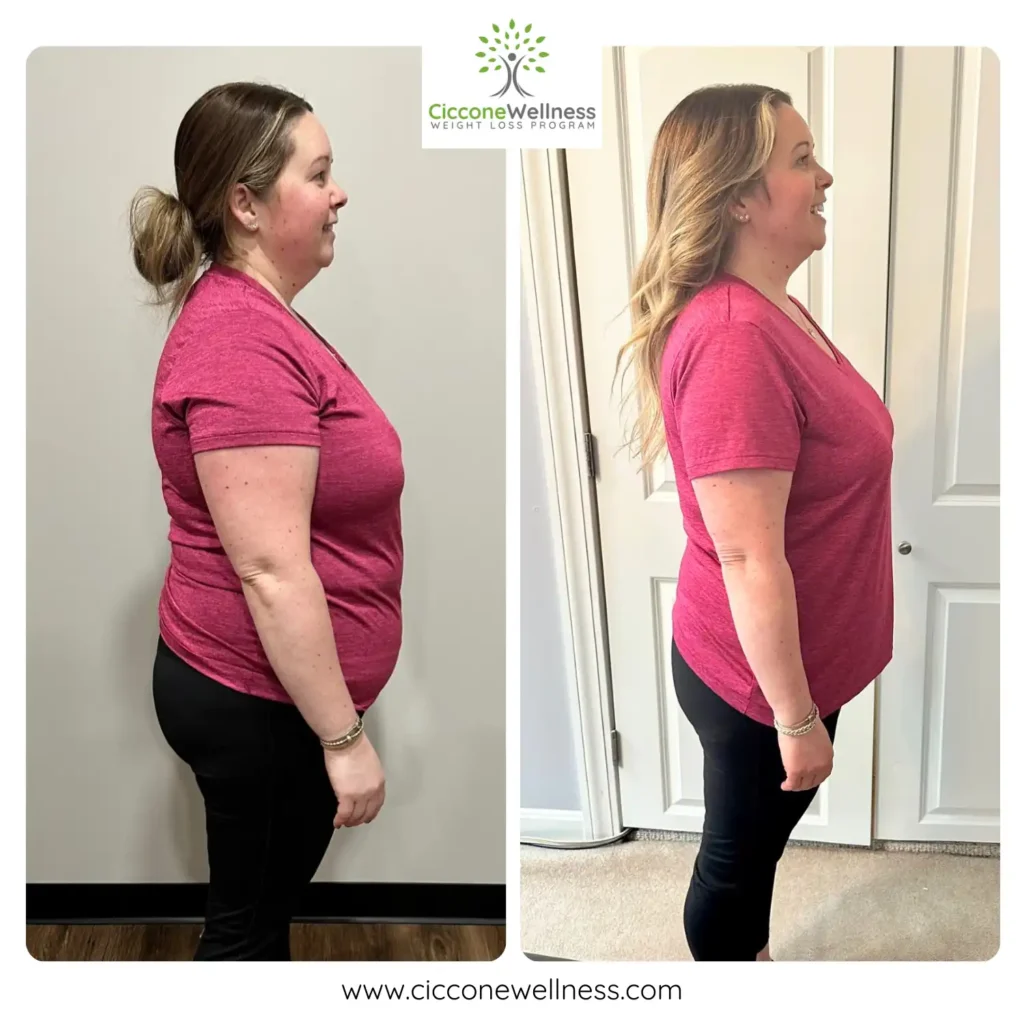 Nicole Q before and after weight loss side view