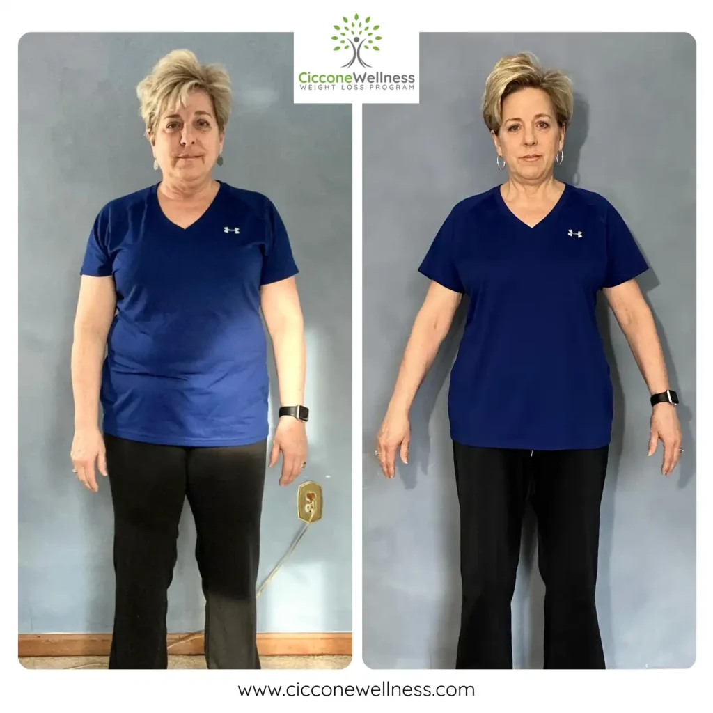 Kim W before and after weight loss front view
