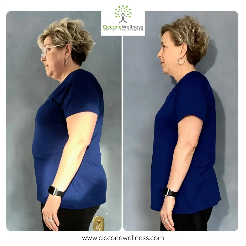 Kim W before and after weight loss side view