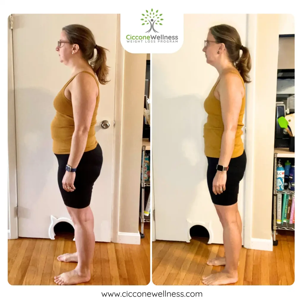 Amanda B before and after weight loss side view