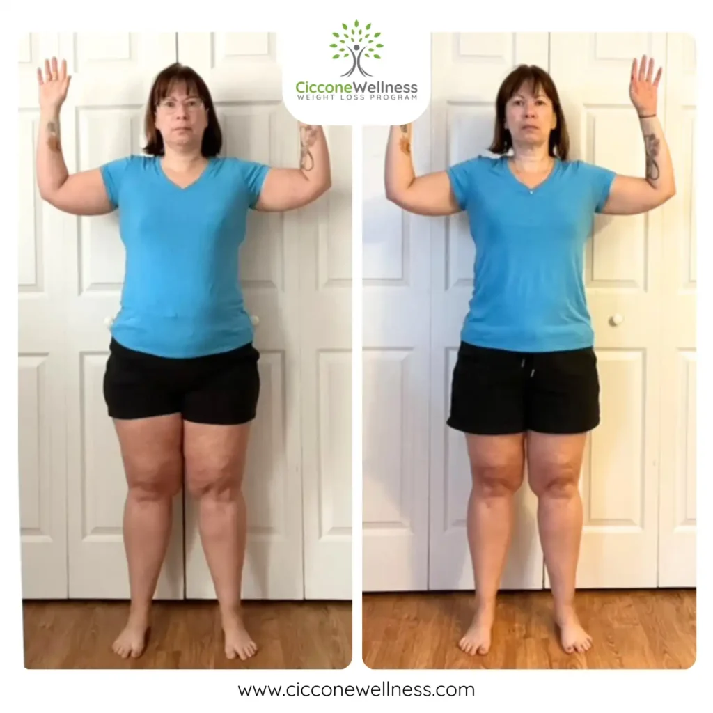 Amanda F before and after weight loss front view
