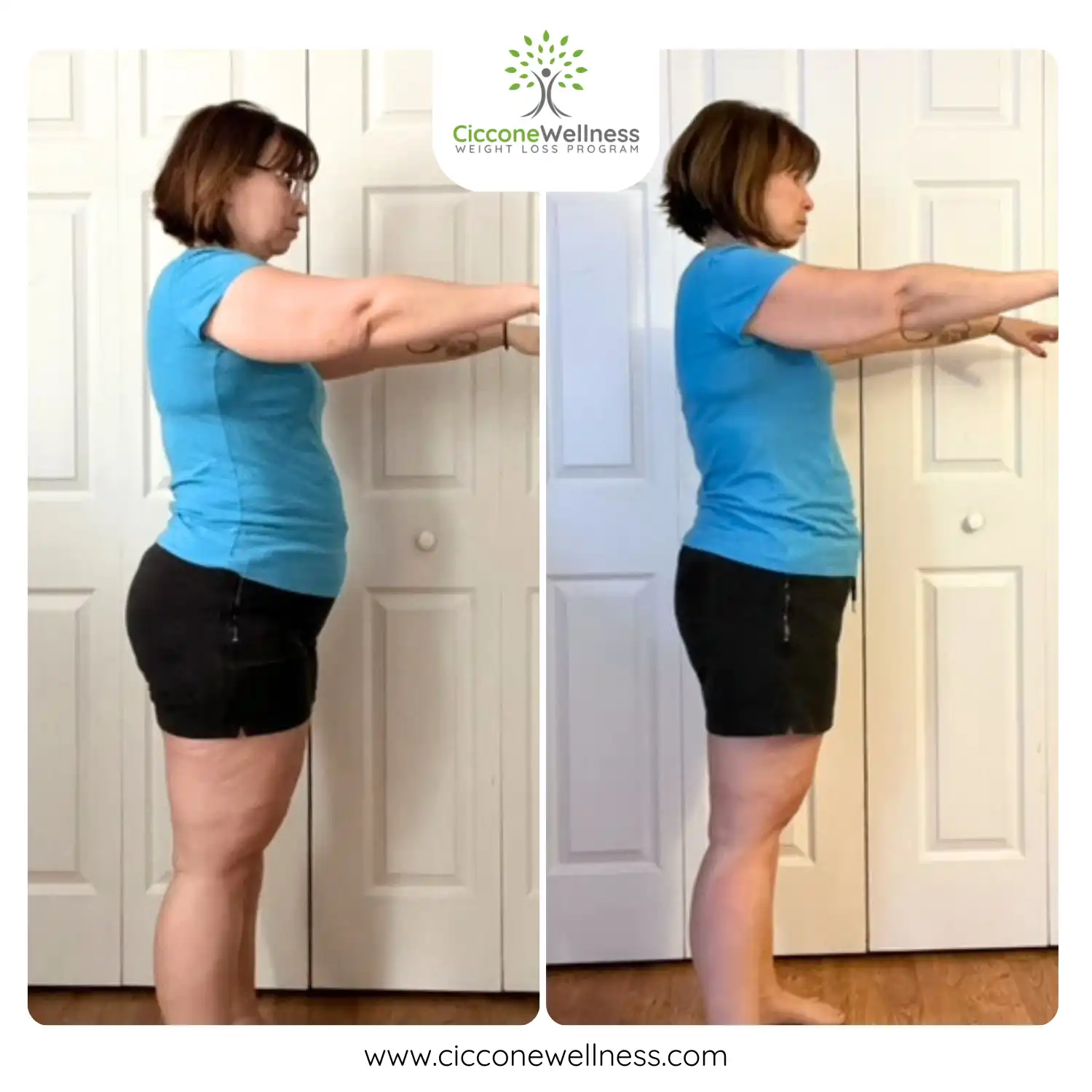Amanda F before and after weight loss side view