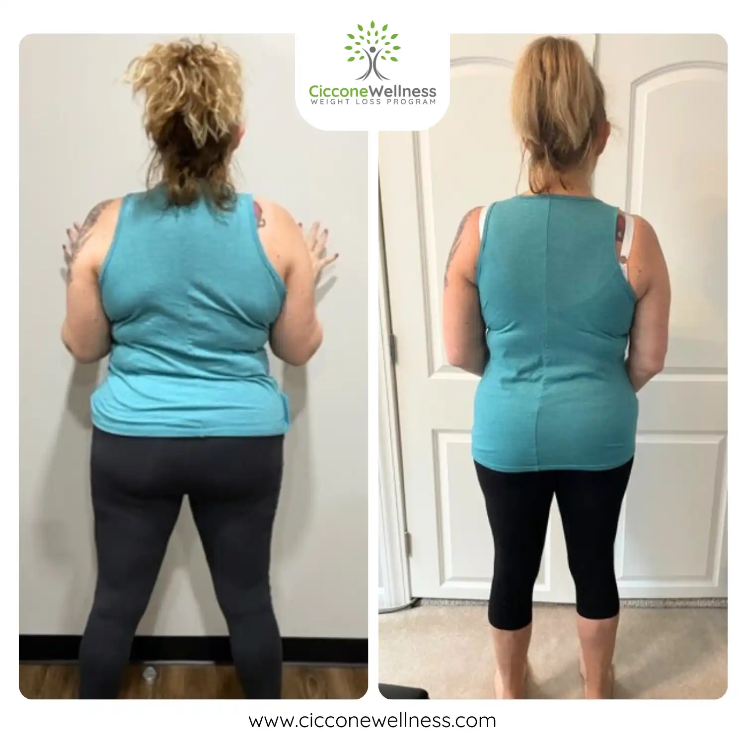 Amy before and after weight loss back view