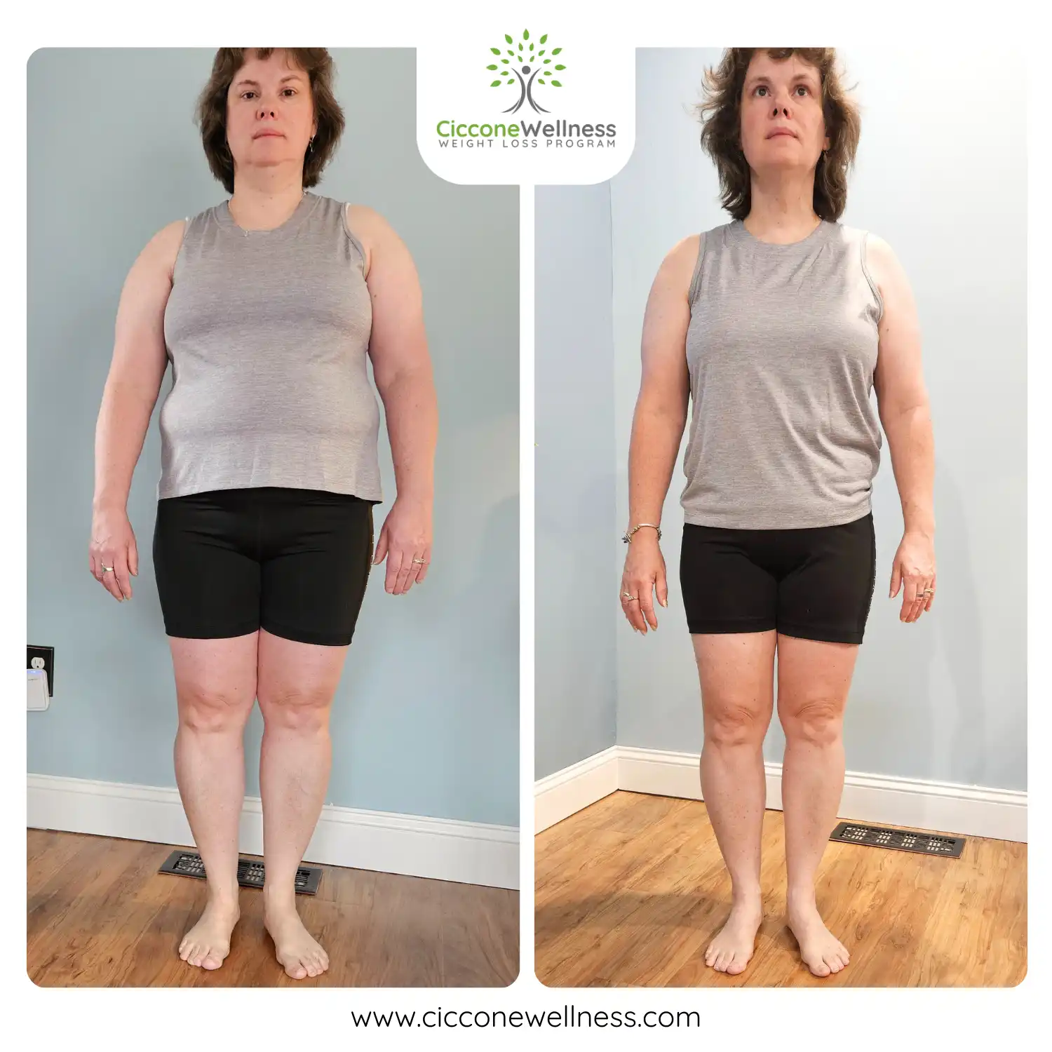 Deb before after weight loss front view