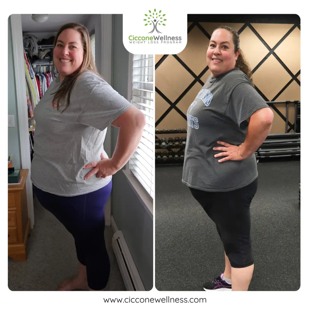 Jenn before and after weight loss side view