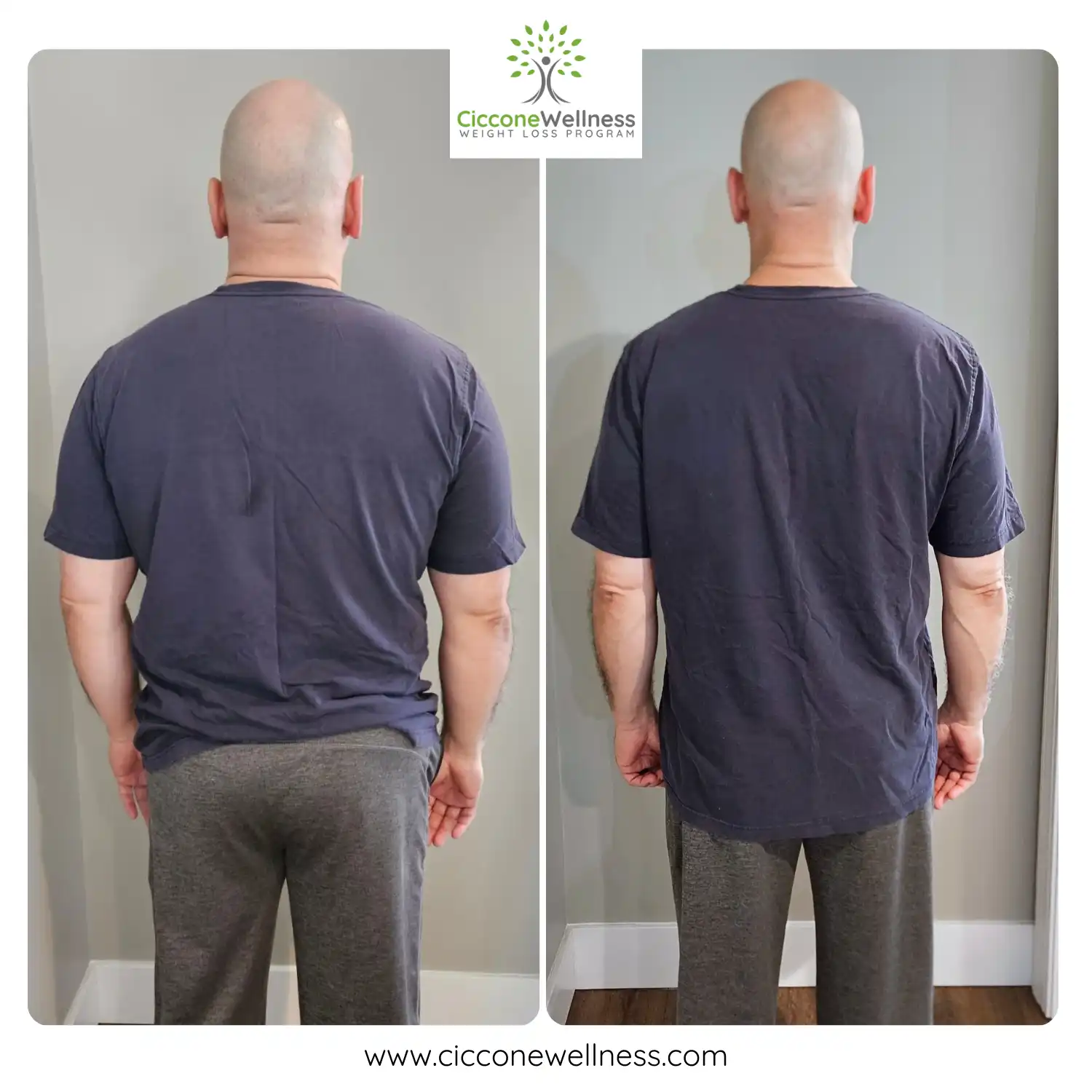 Rafael before and after weight loss back view