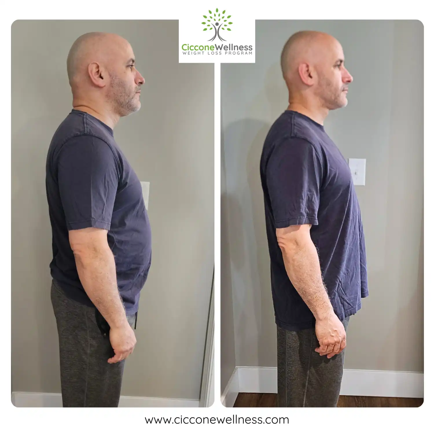 Rafael before and after weight loss side view