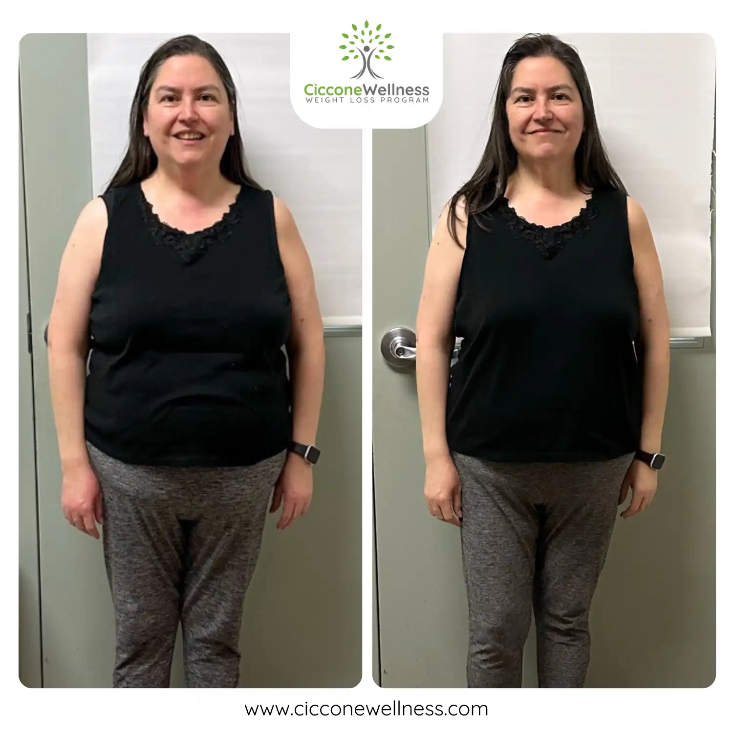 Zenaida before and after weight loss front view