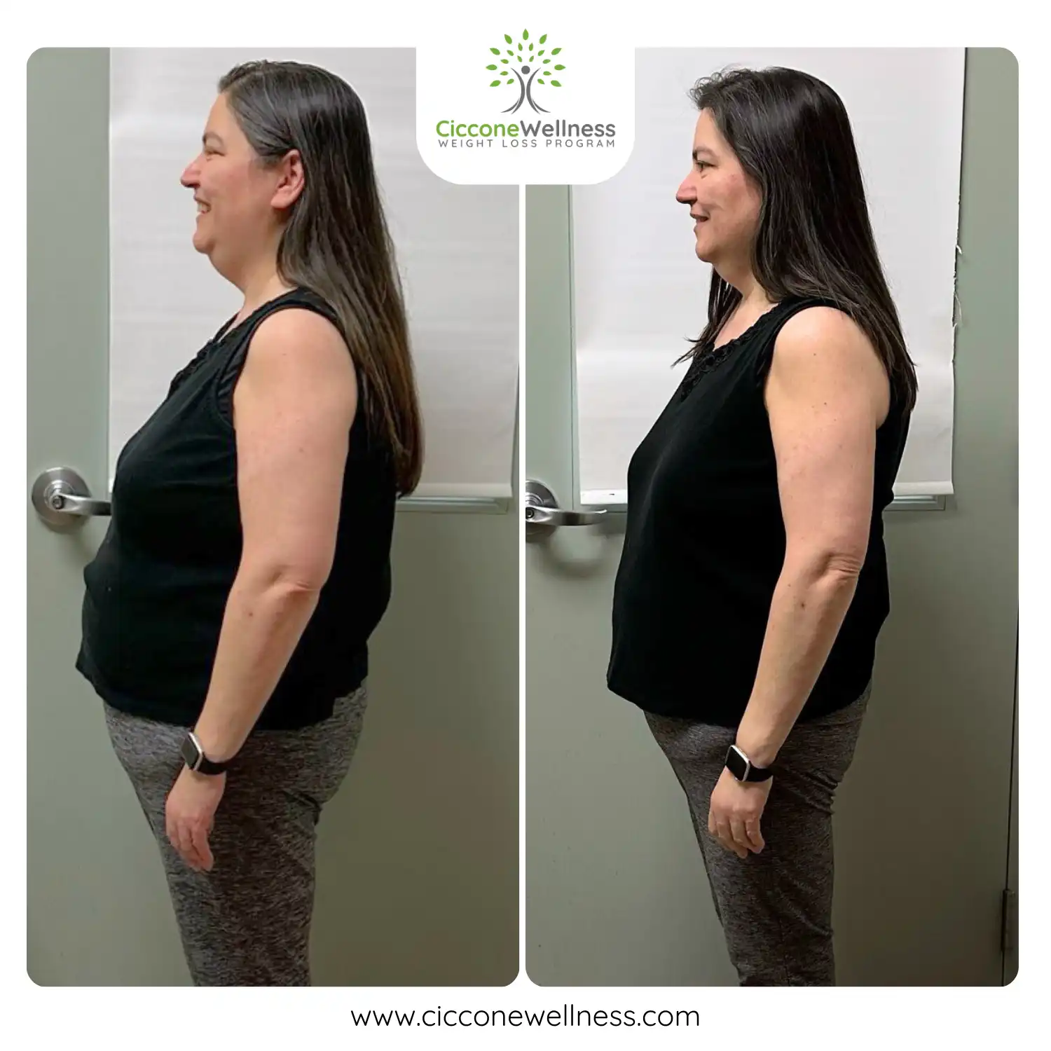 Zenaida before and after weight loss side view