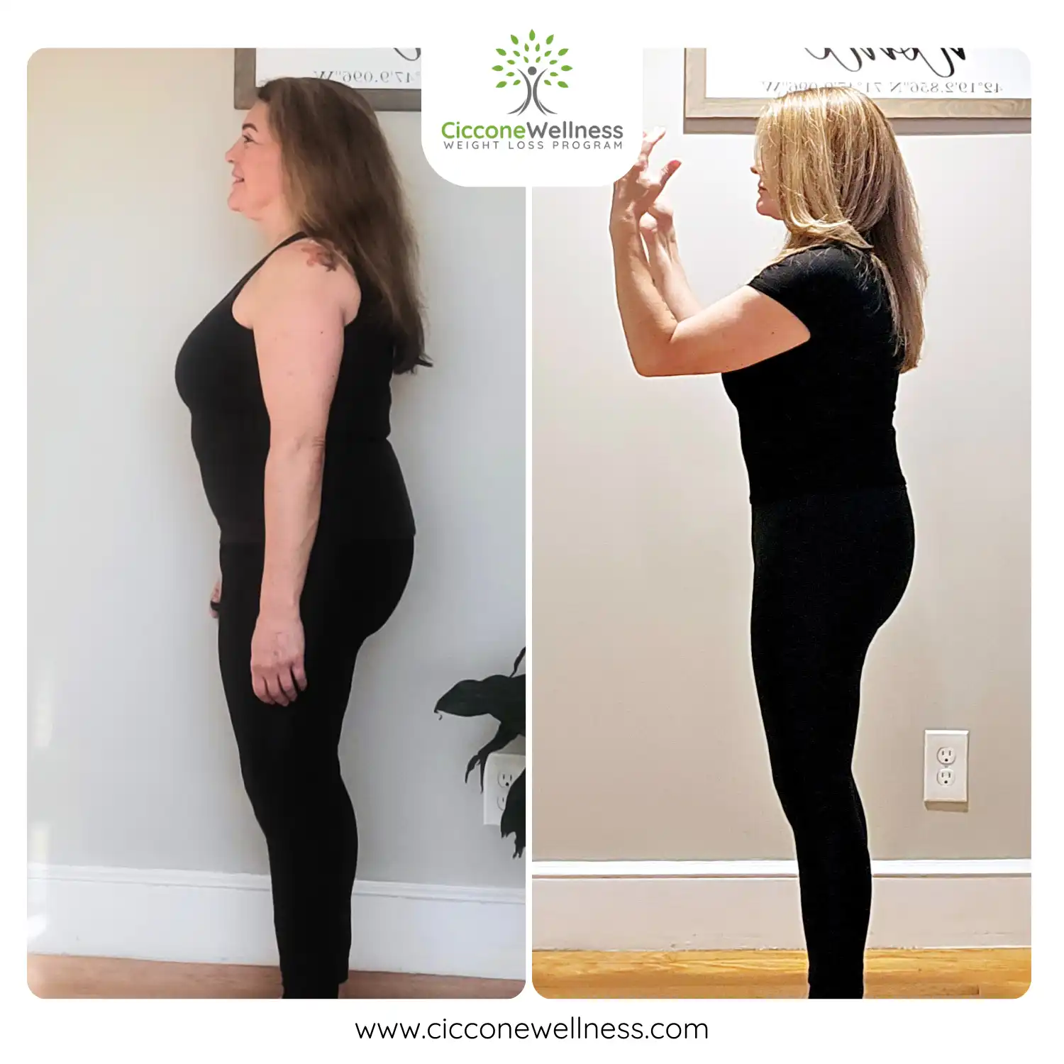 Andrea before and after weight loss side view