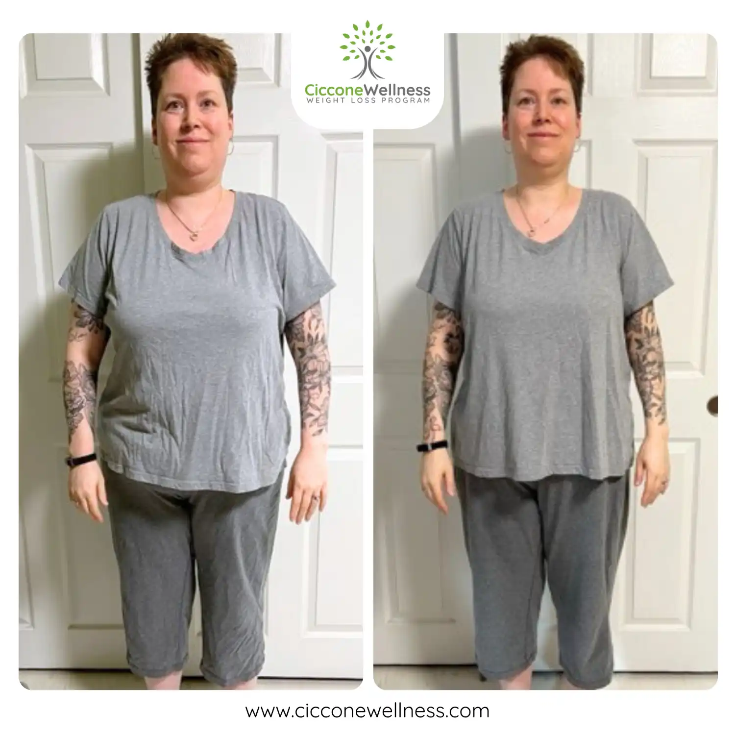 Kelly before and after weight loss front view