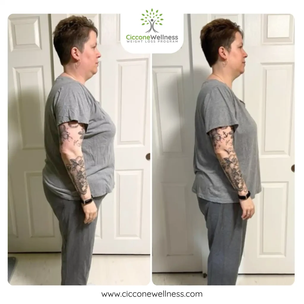 Kelly before and after weight loss side view