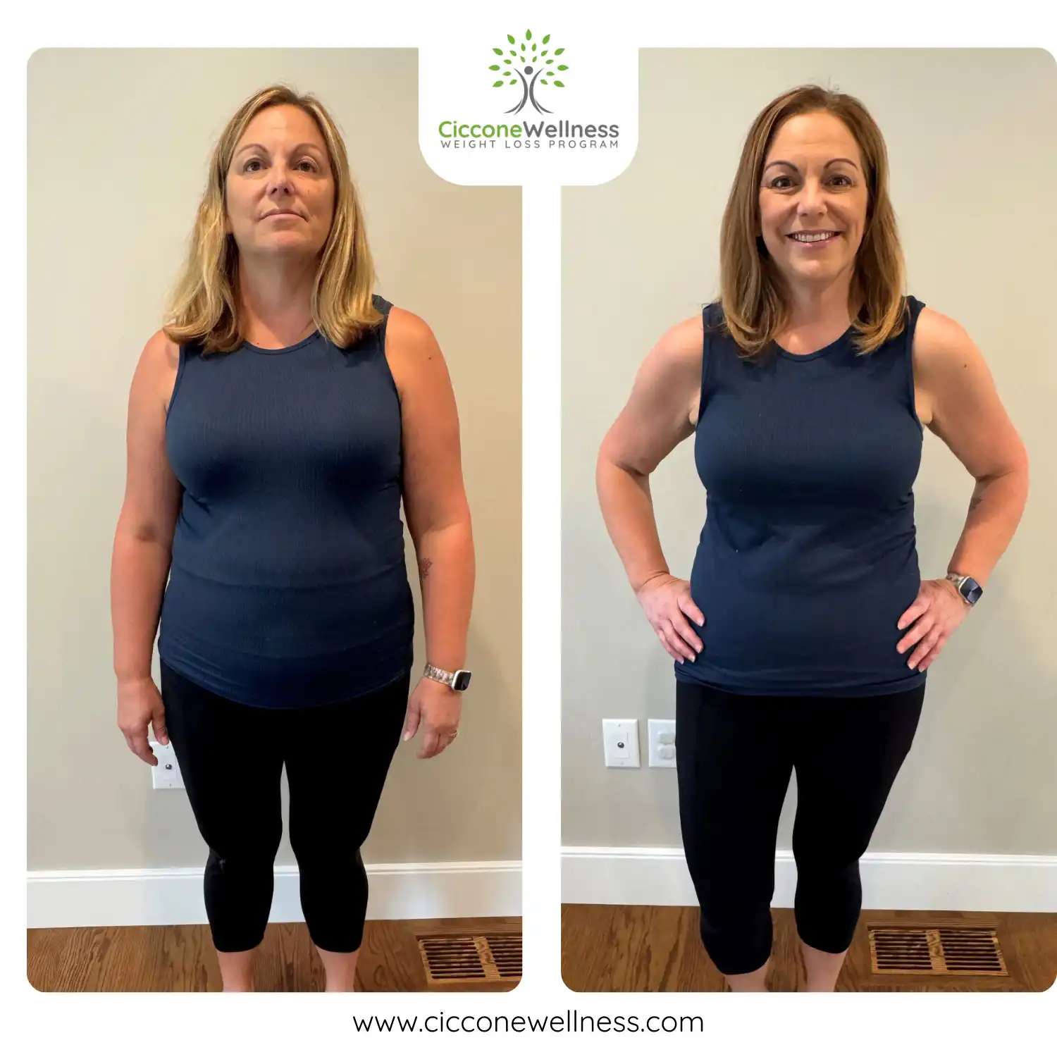 Eileen before and after weight loss front view