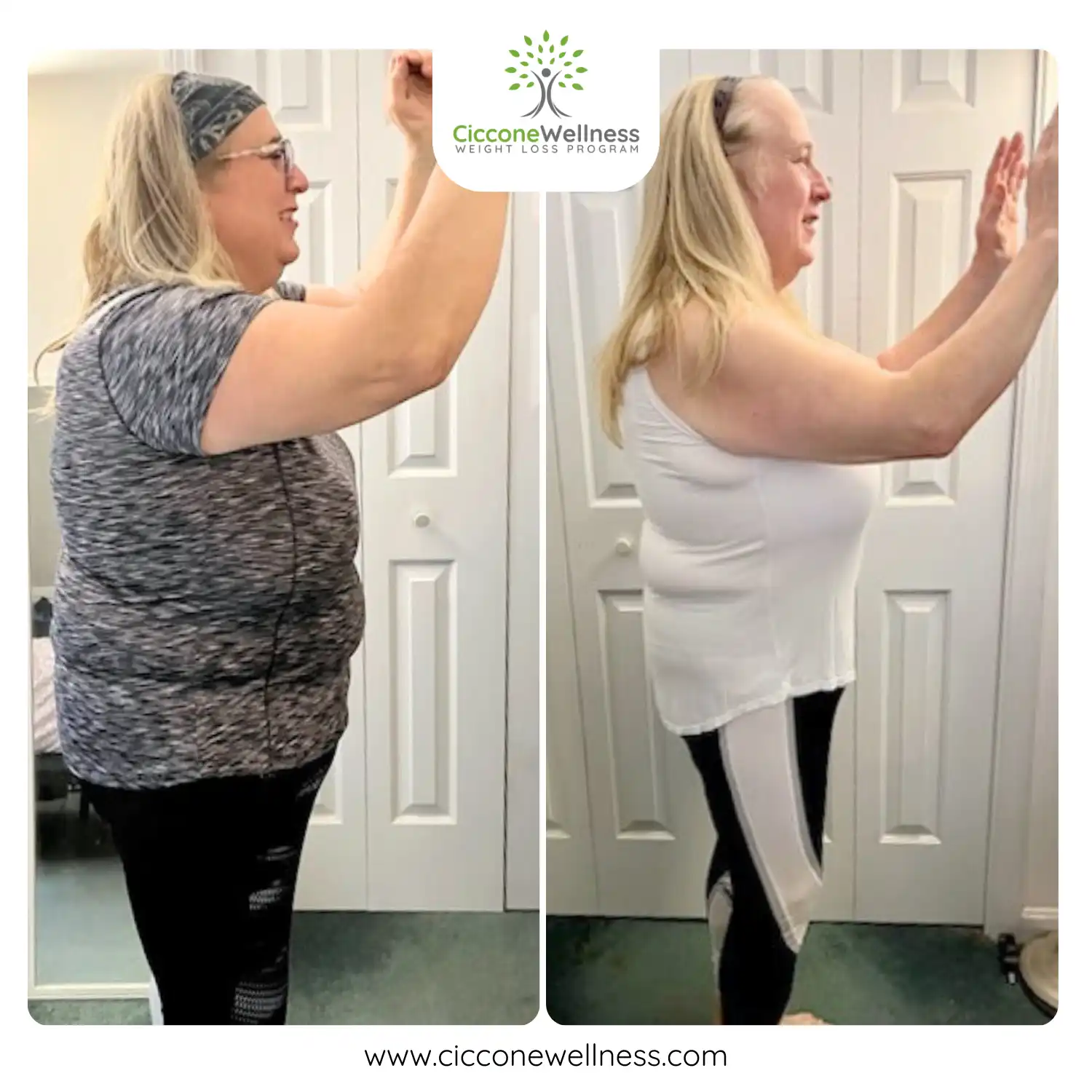 Annastacia before and after weight loss side view