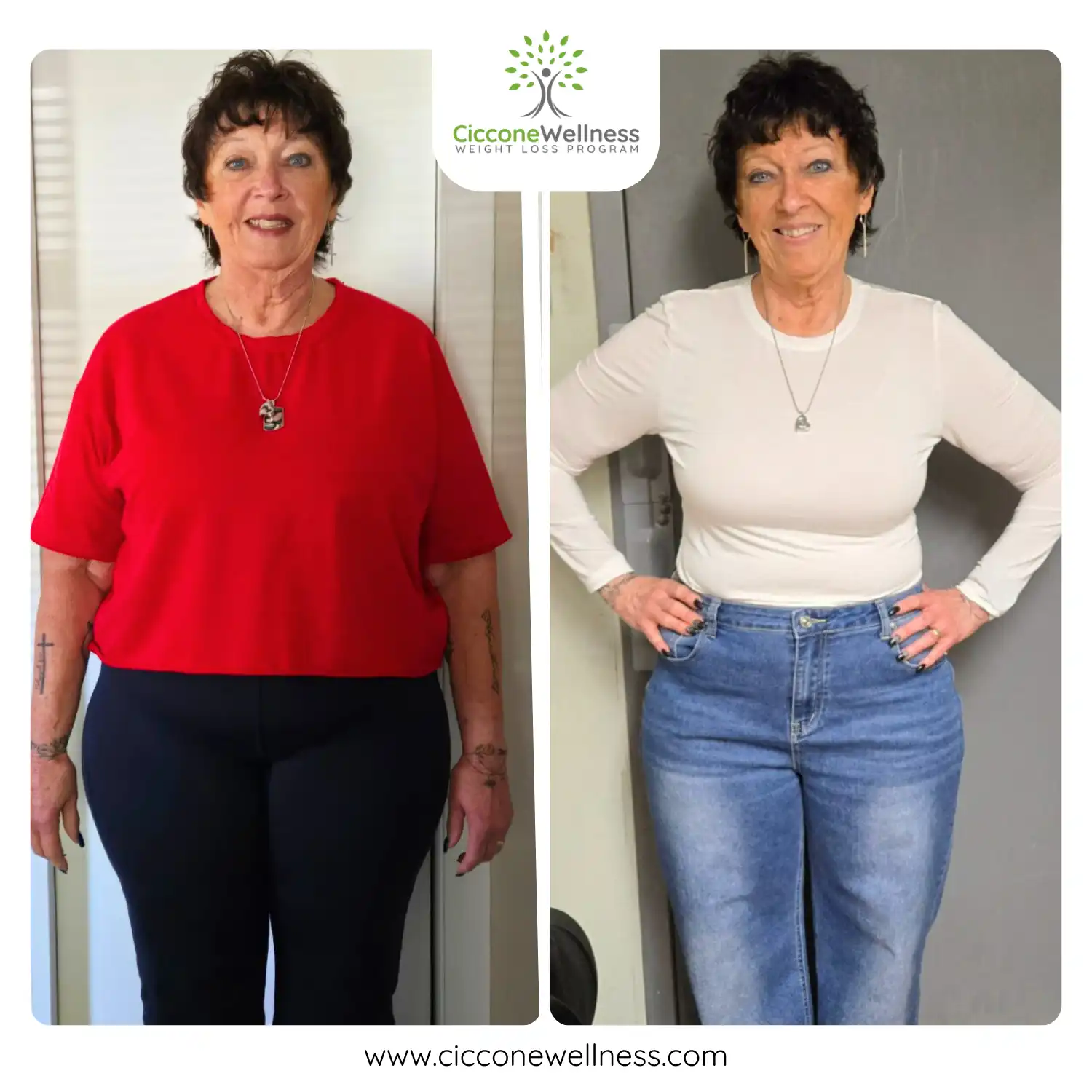 Sharyn before and after weight loss front view