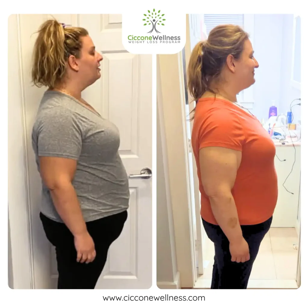 Christina S before & after weight loss side view