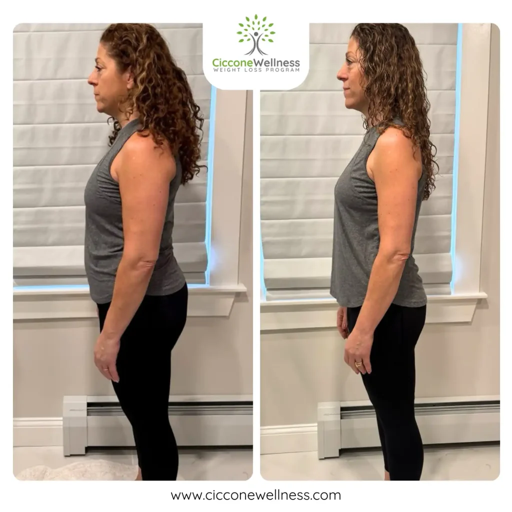 Elaina before and after weight loss side view