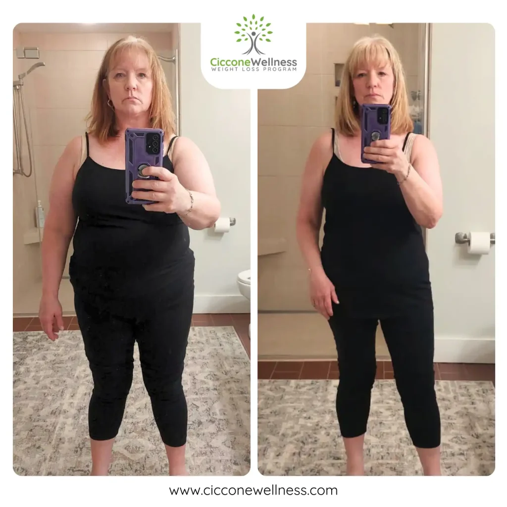 Heidi before and after weight loss front view