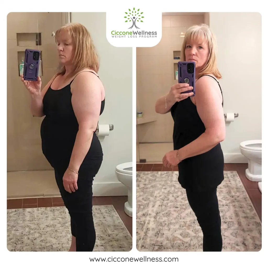 Heidi before and after weight loss side view