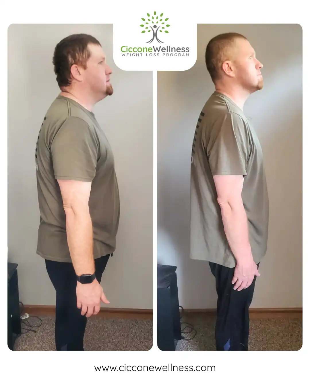 Charles before after weight loss side view